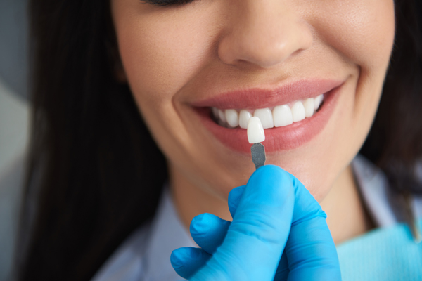 Caring For Your Dental Veneers: Tips For Long Lasting Results